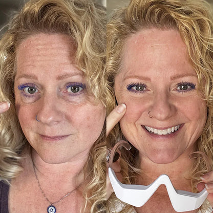 KalmEyes™ 2-in-1 Red Light Therapy + EMS To Erase Eye Bags